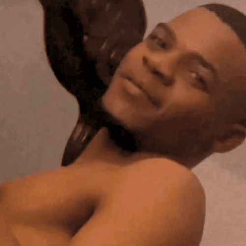 Photo of Rico for a Sepsis Story, Died of Sepsis